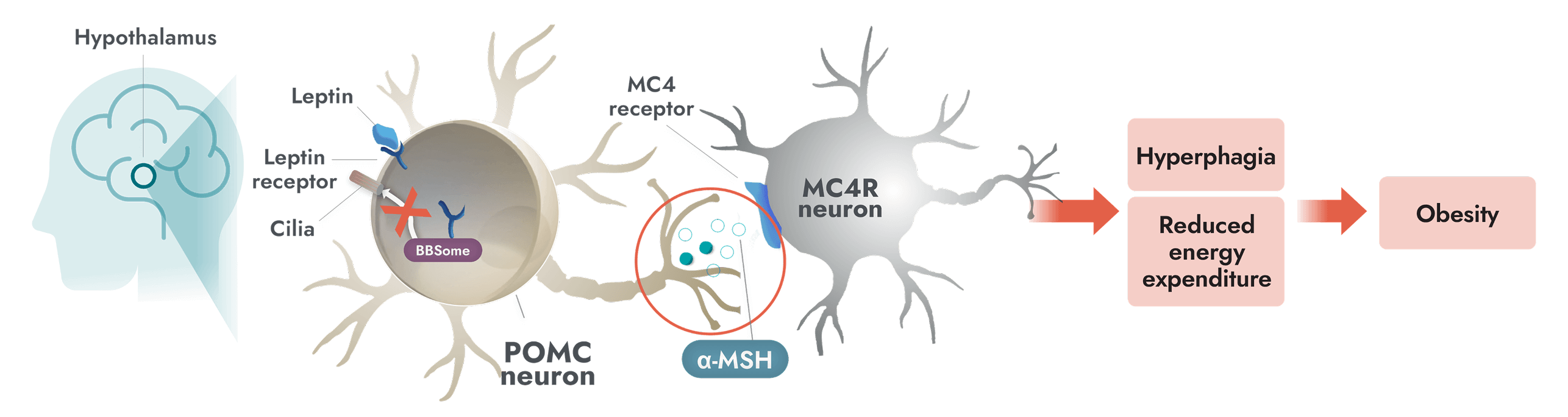 Impaired MC4R pathway activity