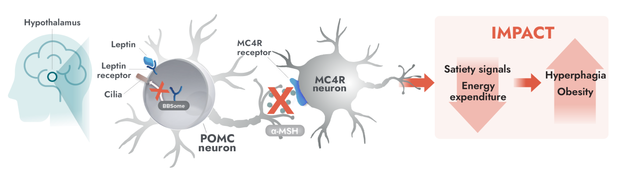 Impaired MC4R pathway activity