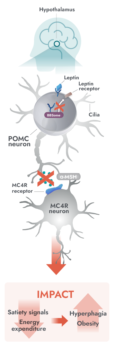 Impaired MC4R pathway activity